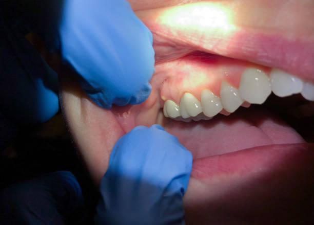 Emergency Dentist Open Today in MD